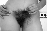 Hairy Places