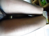 Black feet