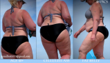 BBW and SSBBW beach voyeur (My work)