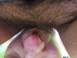 draining cunt juice from fat furry cunt