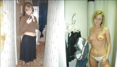 Before and After Teens Collection 1 - N