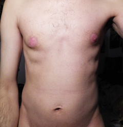 My body with my small penis - N