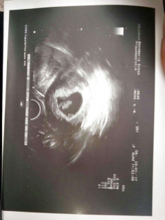 the youngest breeder ... - N